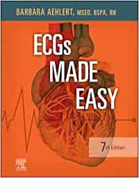Ecg's Made Easy